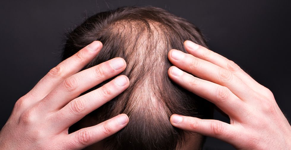 How To Stop Hair Loss & Regrow Hair Naturally