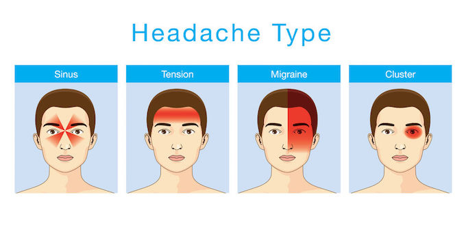 different types of headaches