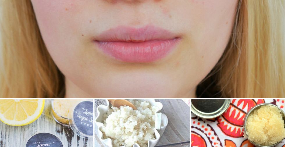 Chapped Lips Treatment: Instant Relief For SUPER Dry Lips